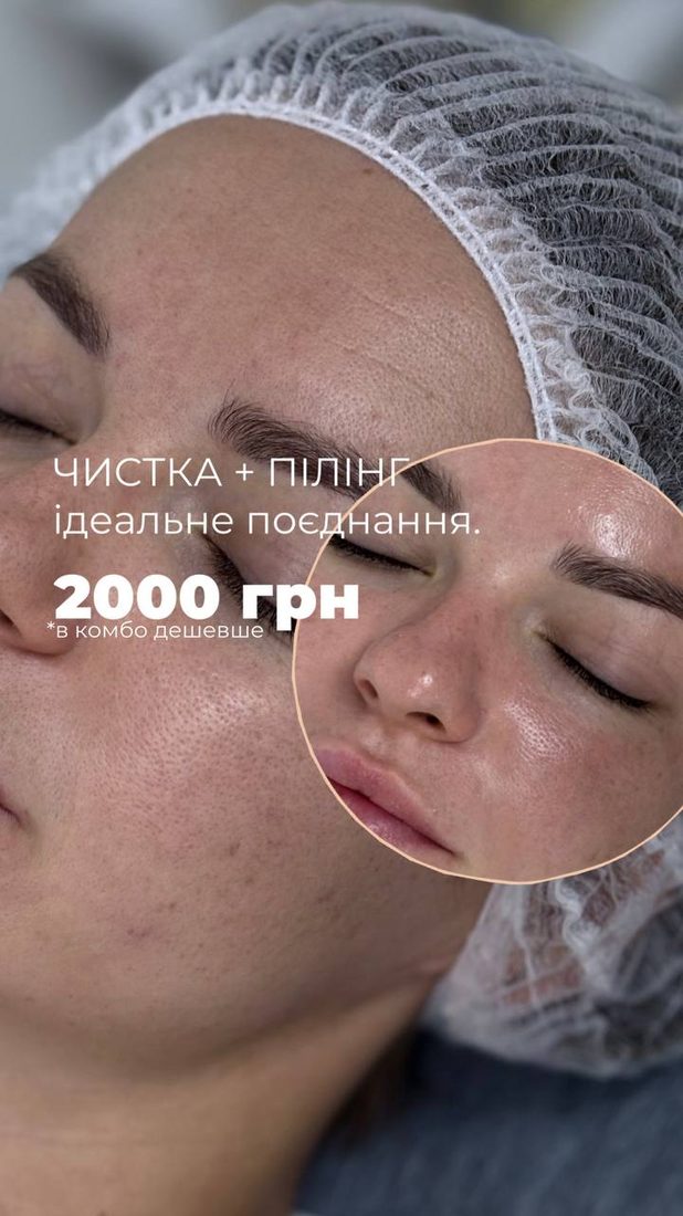 Акція: чистка обличчя + хімічний пілінг — 2000 ₴ (в комбо дешевше)